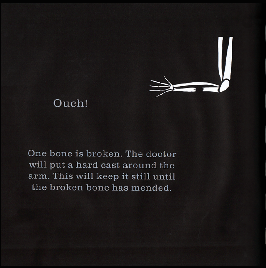 Black t-shirt with a white illustration of a broken arm and text on a black background